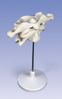 Atlas y axis  A71/1