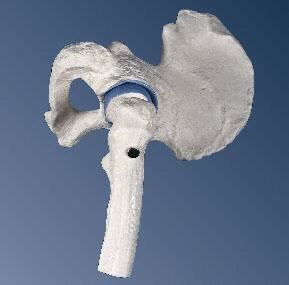 Mini-articulaci�n de la cadera, sin base  A84