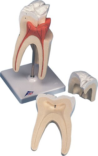 Molar superior con 3 ra�ces  D10/5