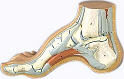 Pie Arqueado (Pes Cavus)  M32