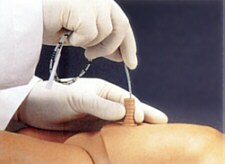 M�dulo de entrenamiento sobre cateterizaci�n umbilical (accesorio p/el maniqu� S100) S100.4