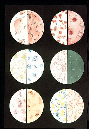 L�mina: Bacterias  V2041U