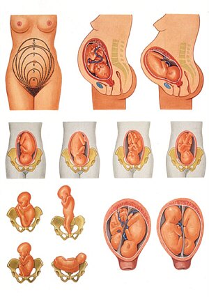 L�mina: Posici�n del Beb� antes del Parto  V2068U