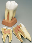 Molar superior de tres ra�ces, 2 piezas  VE298