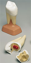 Molar superior de dos ra�ces, 2 piezas  VE299