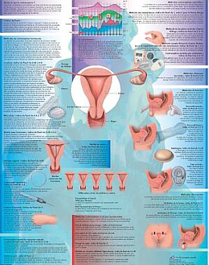 L�mina: Contracepci�n (m�todos anticonceptivos) VR3591