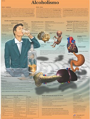 L�mina: Alcoholismo  VR3792