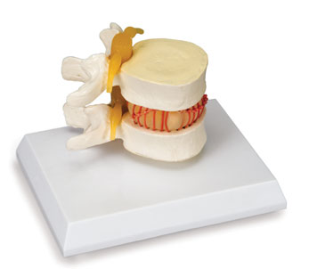 Simulador de Hernia de Disco W22230