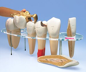 Modelo de pr�tesis dental, 7 piezas, 10 veces su tama�o natural -  Ingl�s  W42517