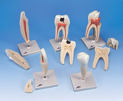 Serie de modelos dentales , 5 modelos  D10