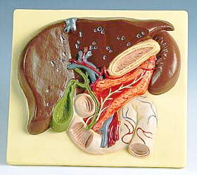 Hígado con vesícula biliar, páncreas y duodeno  VE315