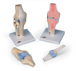 Modelo de la articulación de la rodilla, dividido en 3 partes A89