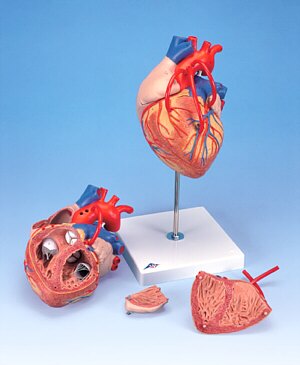 Corazón con bypass, 2 veces el tamaño natural, de 4 piezas G06