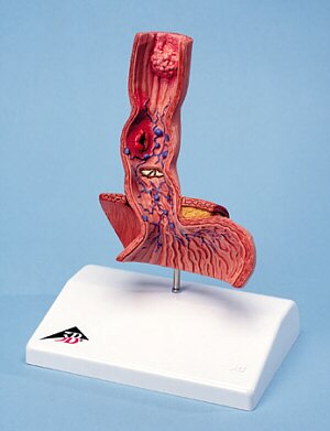 GastroenterologÃa